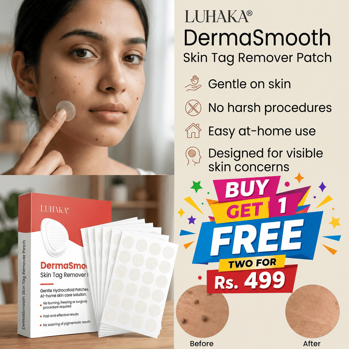 ✨ Tag & Mole Remover (BUY 1 GET 1 FREE) 36 Patch | Gentle, Fast & Easy At-Home Skin Tag Care